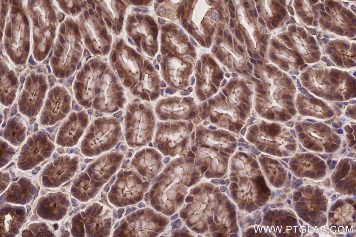 Immunohistochemical analysis of paraffin-embedded mouse stomach tissue slide using KHC2726 (PARD3 IHC Kit).