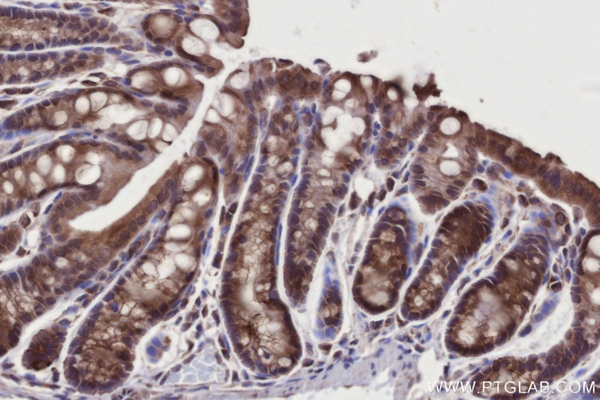 Immunohistochemical analysis of paraffin-embedded mouse colon tissue slide using KHC2726 (PARD3 IHC Kit).