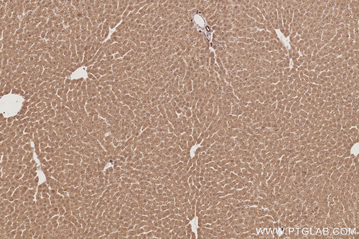Immunohistochemical analysis of paraffin-embedded rat liver tissue slide using KHC2887 (PARD6B IHC Kit). Immunohistochemical analysis of paraffin-embedded rat liver tissue slide using KHC2887 (PARD6B IHC Kit).