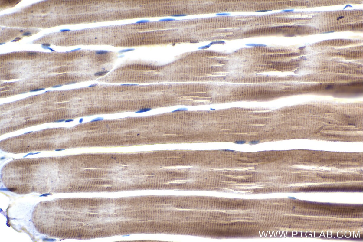 Immunohistochemical analysis of paraffin-embedded rat skeletal muscle tissue slide using KHC1462 (PARK2 IHC Kit).