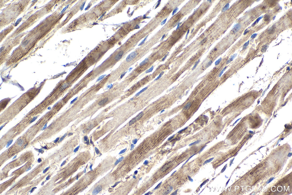 Immunohistochemical analysis of paraffin-embedded rat heart tissue slide using KHC1462 (PARK2 IHC Kit).