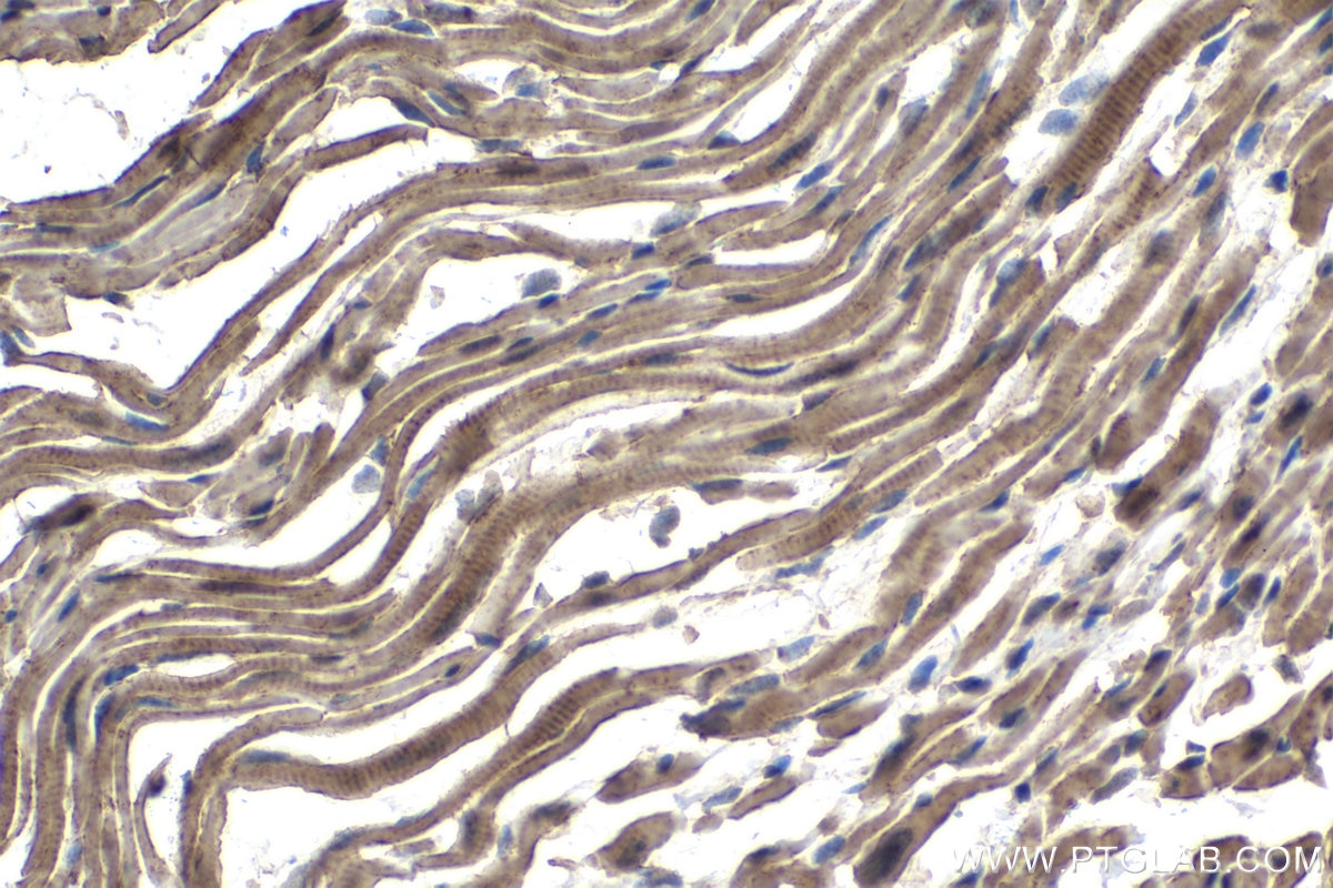 Immunohistochemical analysis of paraffin-embedded mouse heart tissue slide using KHC1462 (PARK2 IHC Kit).