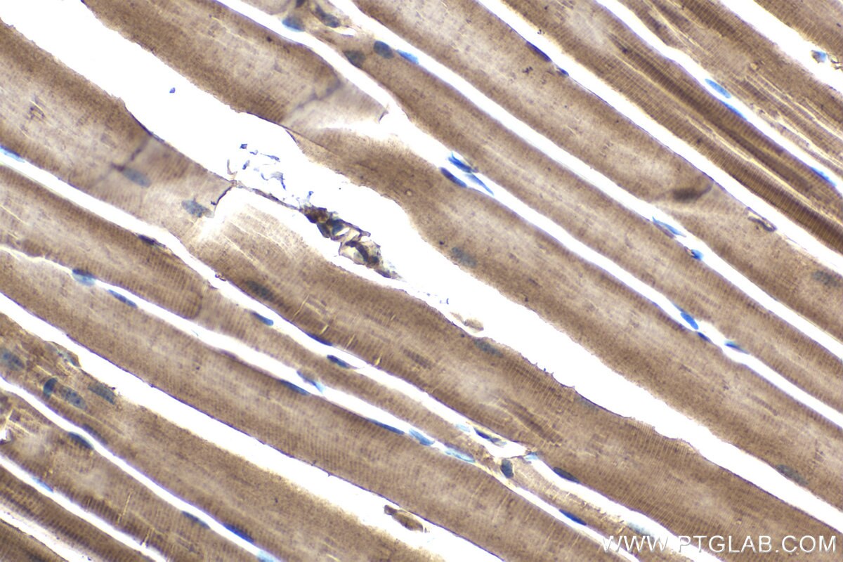 Immunohistochemical analysis of paraffin-embedded mouse skeletal muscle tissue slide using KHC1462 (PARK2 IHC Kit).