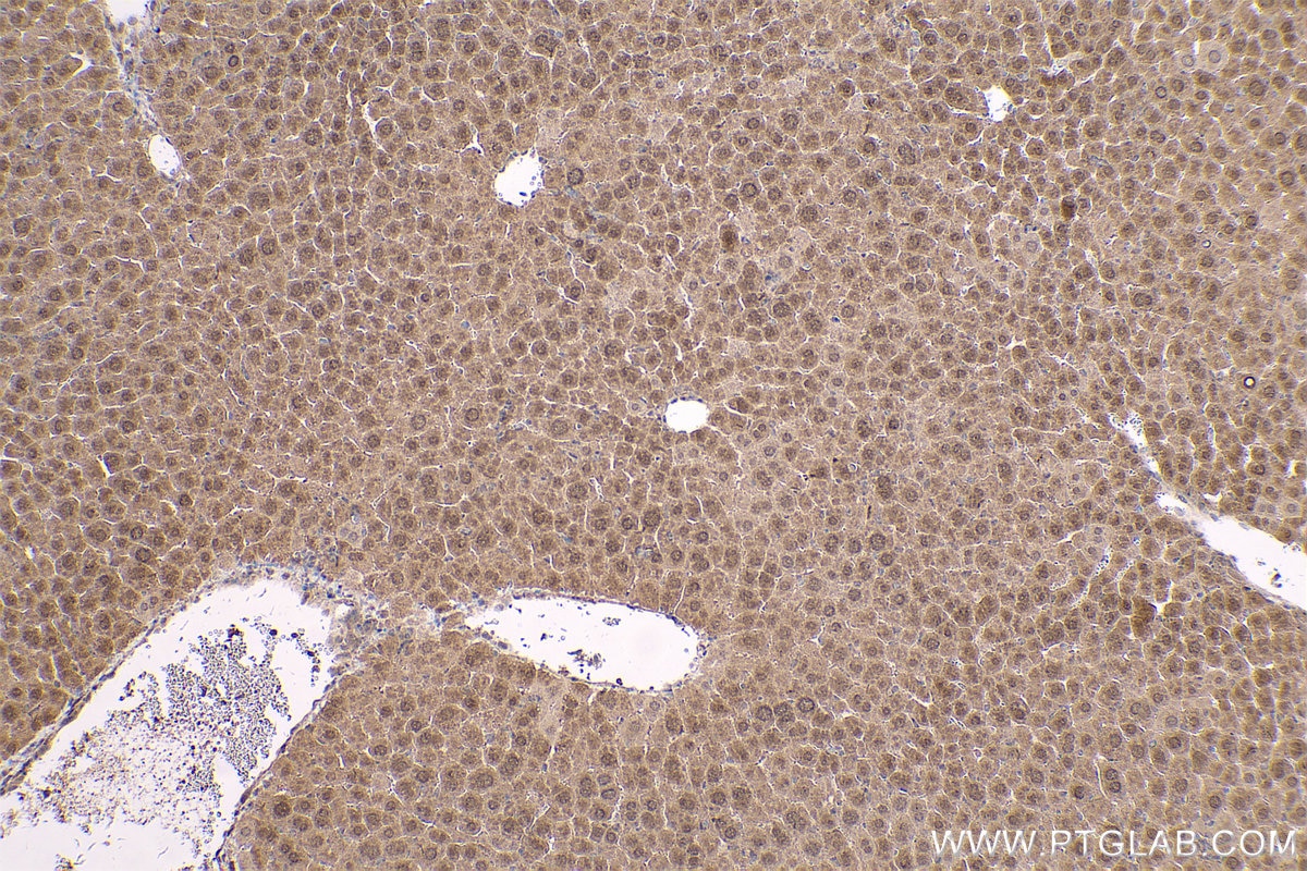 Immunohistochemical analysis of paraffin-embedded mouse liver tissue slide using KHC0557 (PARK7 IHC Kit).