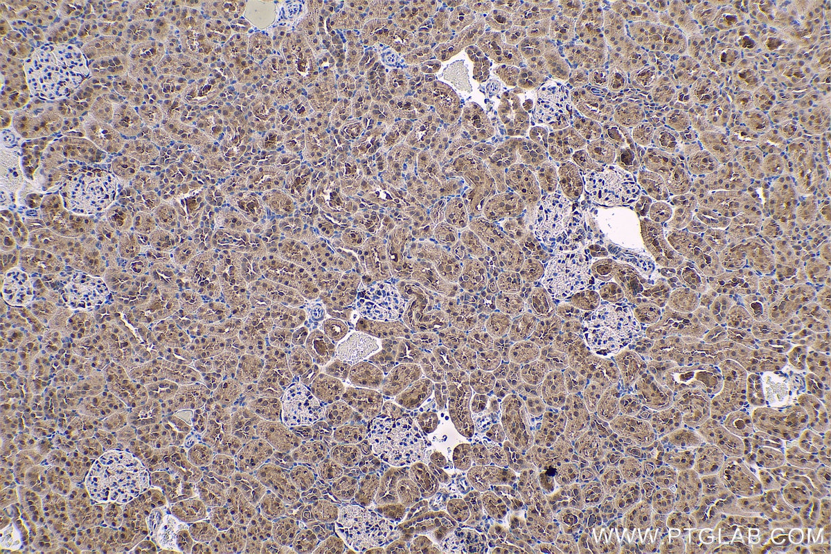 Immunohistochemical analysis of paraffin-embedded rat kidney tissue slide using KHC0557 (PARK7 IHC Kit).