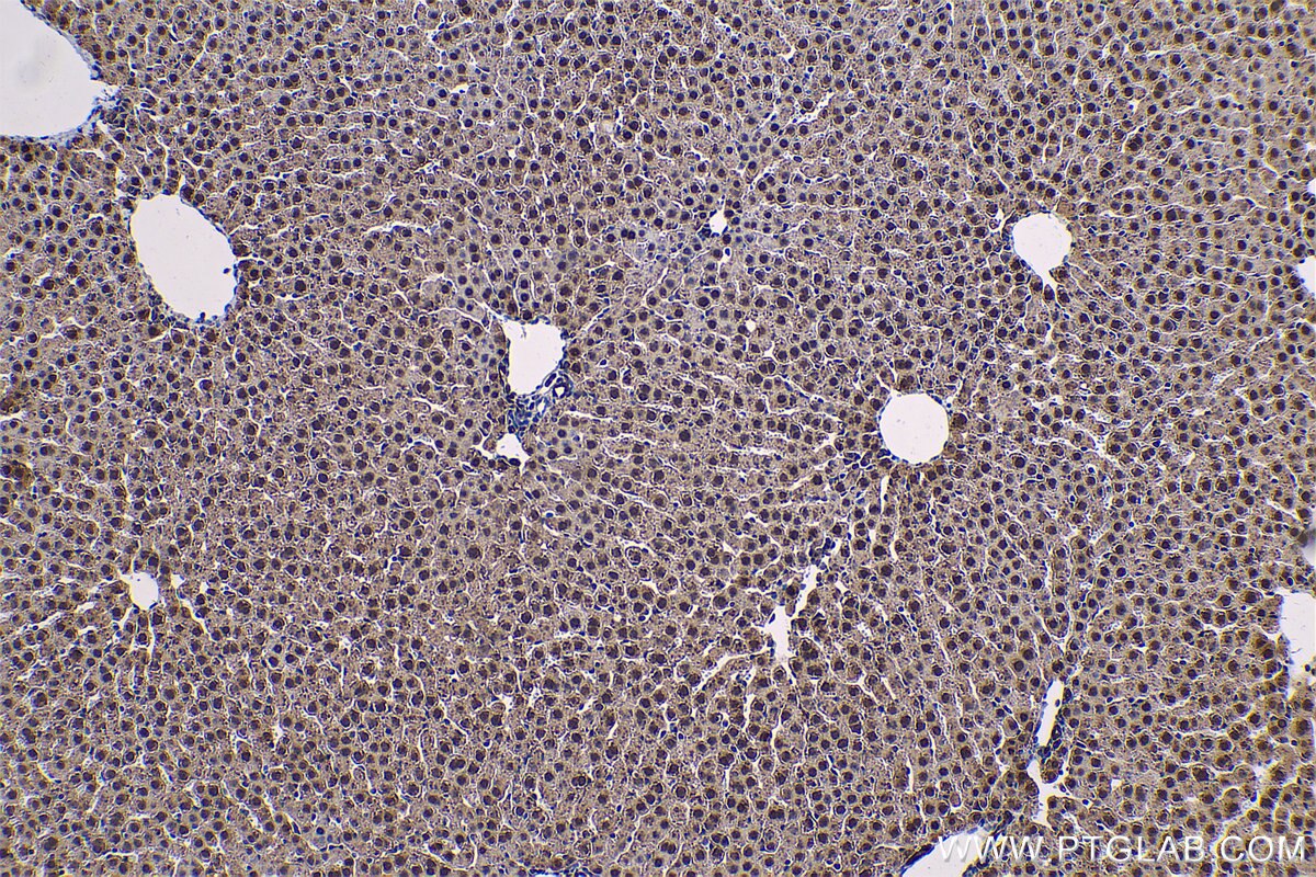 Immunohistochemical analysis of paraffin-embedded rat liver tissue slide using KHC0557 (PARK7 IHC Kit).