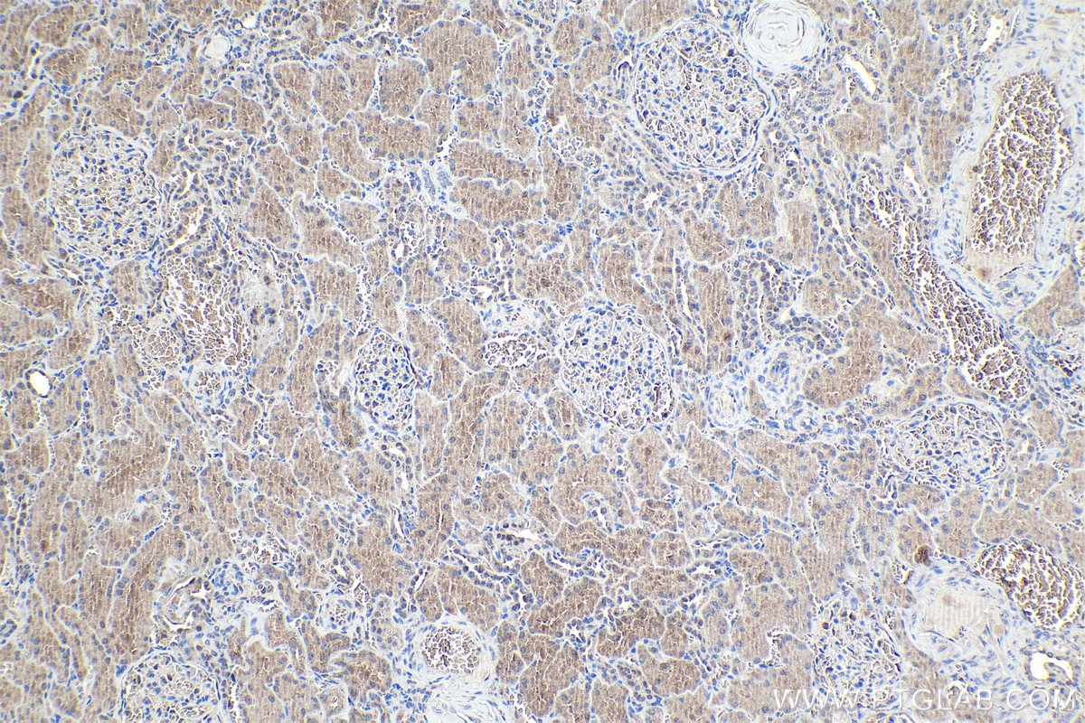 Immunohistochemical analysis of paraffin-embedded human kidney tissue slide using KHC1016 (PARN IHC Kit).