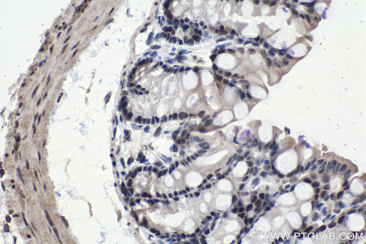 Immunohistochemical analysis of paraffin-embedded mouse colon tissue slide using KHC1016 (PARN IHC Kit).