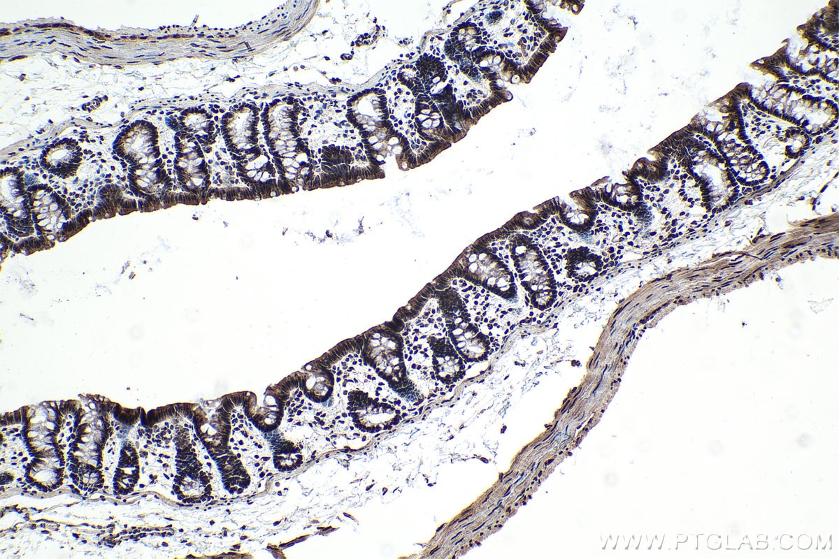 Immunohistochemical analysis of paraffin-embedded rat colon tissue slide using KHC1069 (PARP1 IHC Kit).