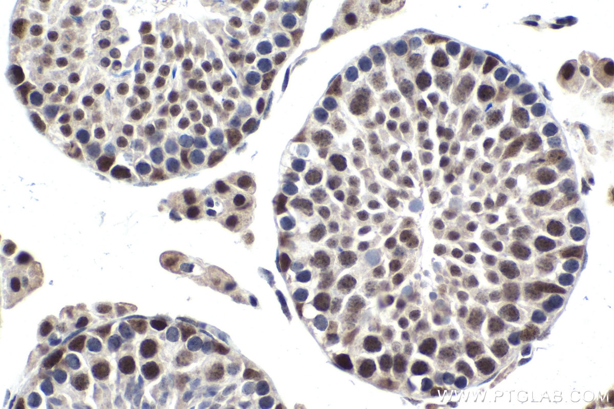 Immunohistochemical analysis of paraffin-embedded mouse testis tissue slide using KHC1069 (PARP1 IHC Kit).