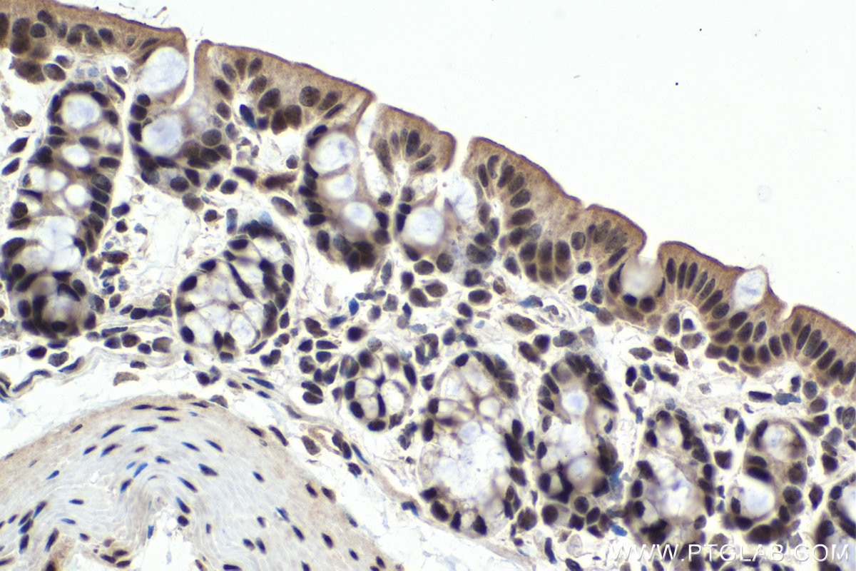 Immunohistochemical analysis of paraffin-embedded mouse colon tissue slide using KHC1069 (PARP1 IHC Kit).