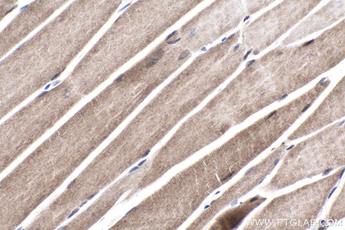 Immunohistochemical analysis of paraffin-embedded mouse skeletal muscle tissue slide using KHC1773 (PARP10 IHC Kit).