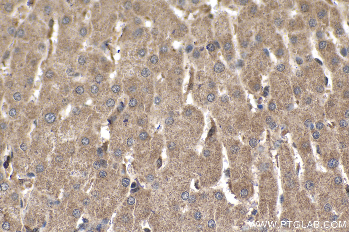 Immunohistochemical analysis of paraffin-embedded human liver tissue slide using KHC1773 (PARP10 IHC Kit).