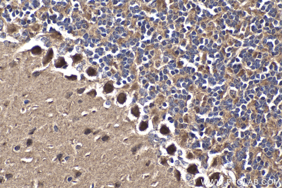 Immunohistochemical analysis of paraffin-embedded mouse cerebellum tissue slide using KHC1773 (PARP10 IHC Kit).