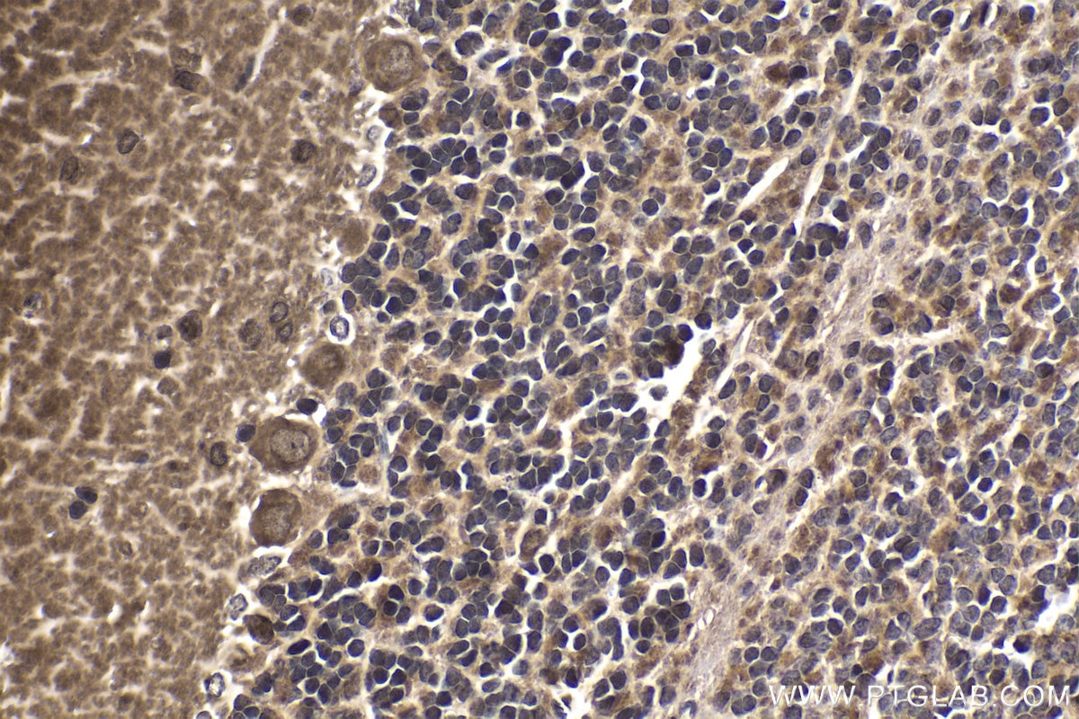 Immunohistochemical analysis of paraffin-embedded rat cerebellum tissue slide using KHC1773 (PARP10 IHC Kit).
