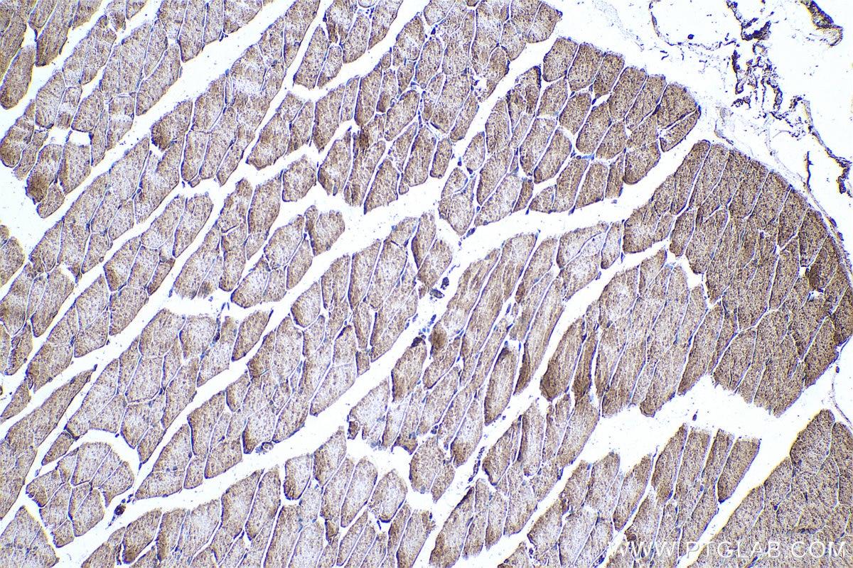 Immunohistochemical analysis of paraffin-embedded mouse skeletal muscle tissue slide using KHC0720 (PARVA IHC Kit).