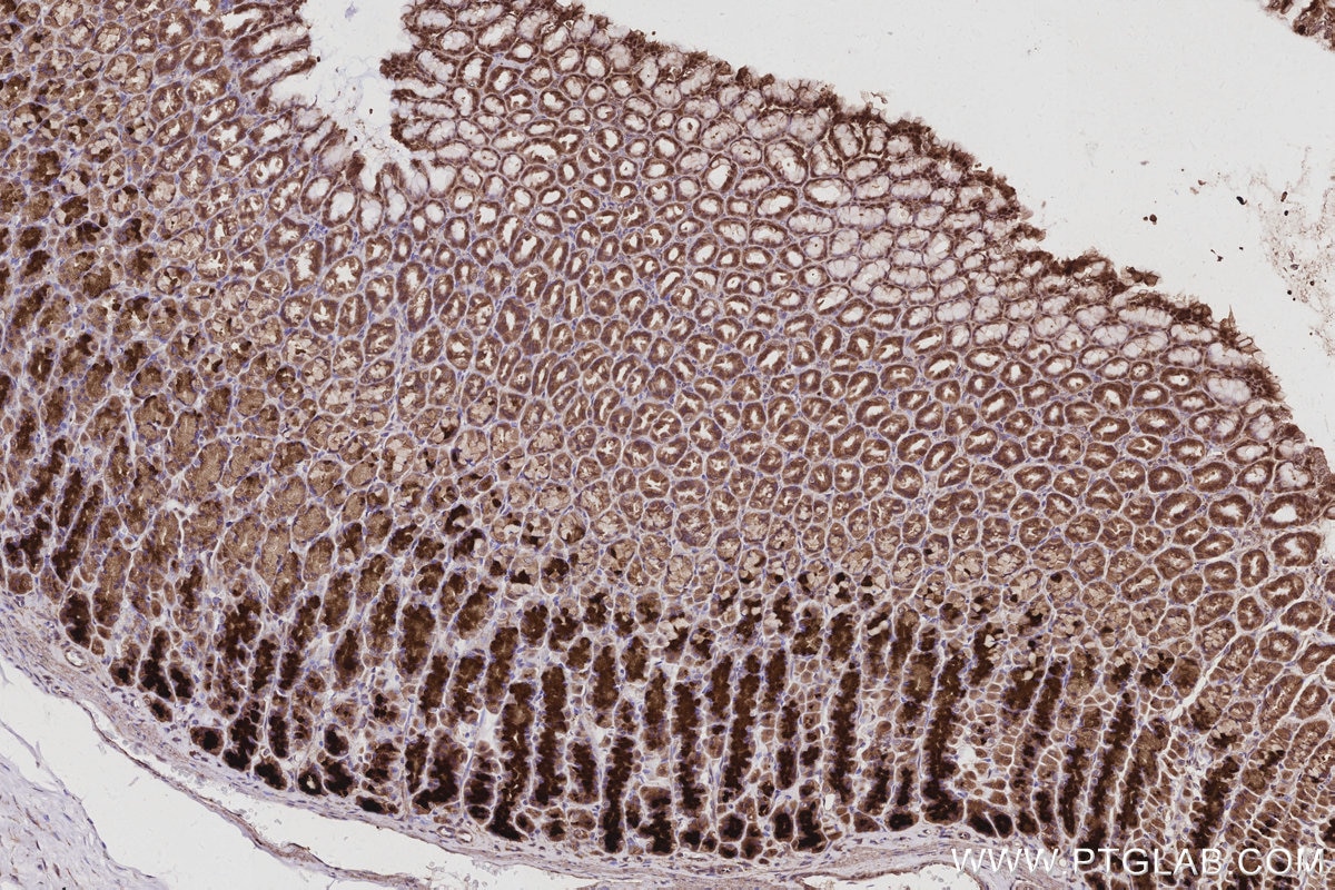 Immunohistochemical analysis of paraffin-embedded rat stomach tissue slide using KHC2960 (PARVB IHC Kit). Immunohistochemical analysis of paraffin-embedded rat stomach tissue slide using KHC2960 (PARVB IHC Kit).