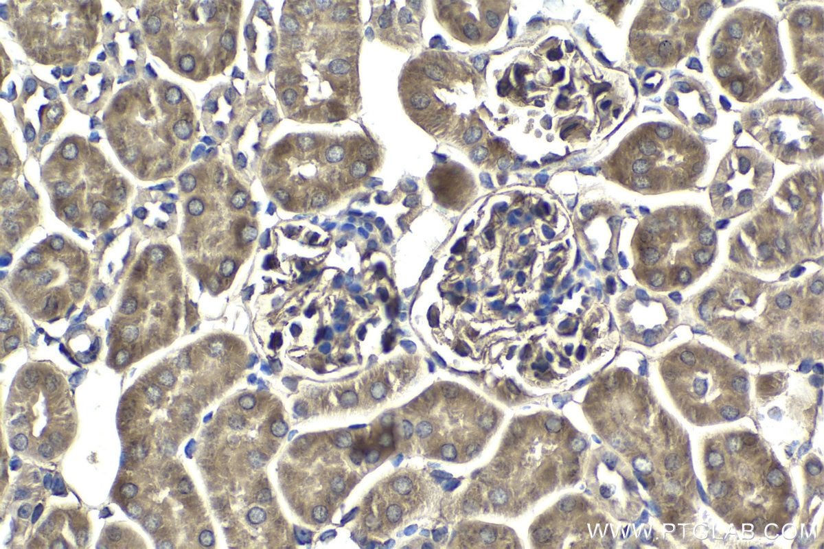 Immunohistochemical analysis of paraffin-embedded mouse kidney tissue slide using KHC1874 (PAWR IHC Kit).