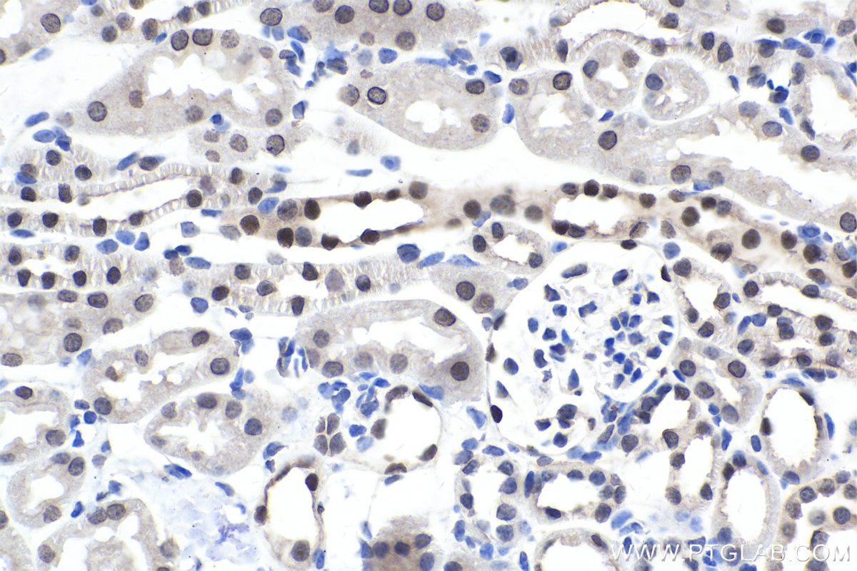 Immunohistochemical analysis of paraffin-embedded mouse kidney tissue slide using KHC1671 (PAX2 IHC Kit).