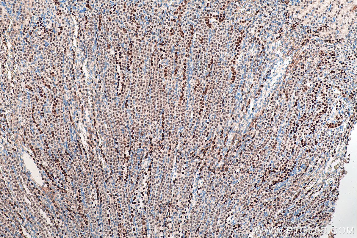 Immunohistochemical analysis of paraffin-embedded mouse kidney tissue slide using KHC0038 (PAX8 IHC Kit).