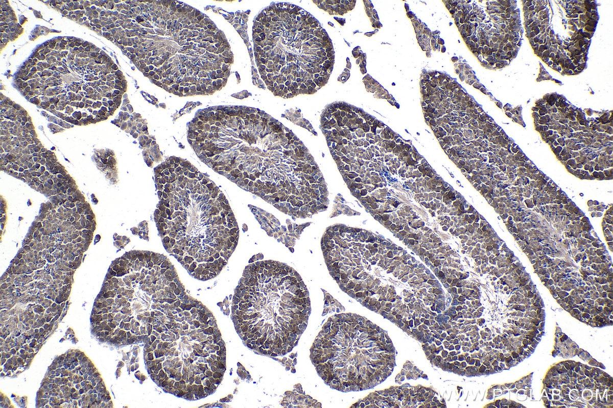 Immunohistochemical analysis of paraffin-embedded mouse testis tissue slide using KHC1034 (PBK IHC Kit).