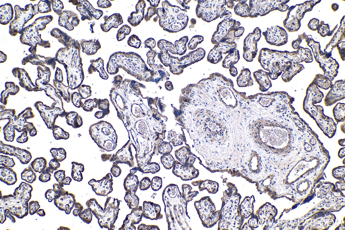 Immunohistochemical analysis of paraffin-embedded human placenta tissue slide using KHC1034 (PBK IHC Kit).