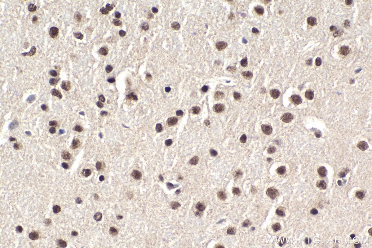 Immunohistochemical analysis of paraffin-embedded mouse brain tissue slide using KHC1815 (PBRM1 IHC Kit).