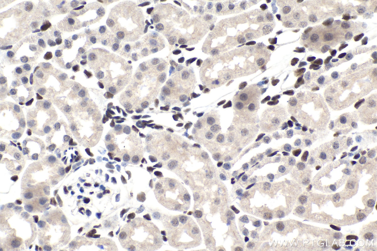 Immunohistochemical analysis of paraffin-embedded mouse kidney tissue slide using KHC1593 (PBX1 IHC Kit).