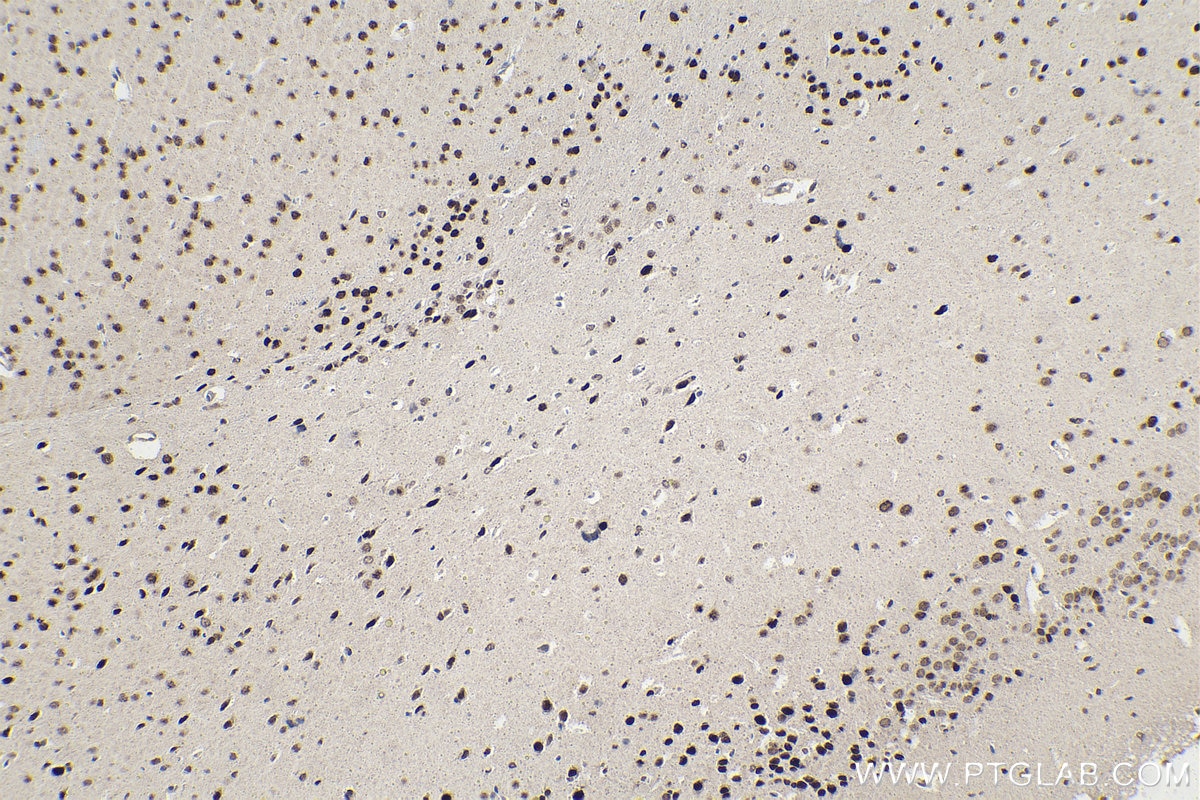 Immunohistochemical analysis of paraffin-embedded mouse brain tissue slide using KHC1593 (PBX1 IHC Kit).