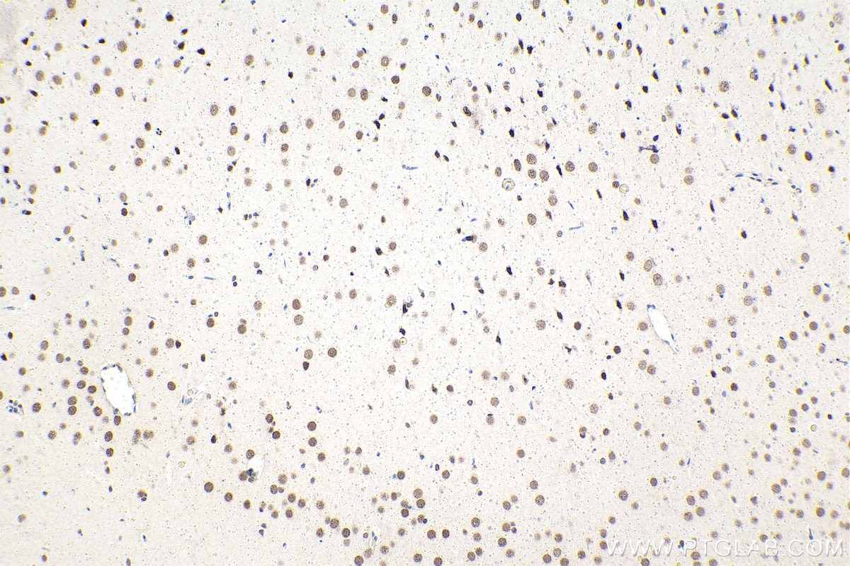 Immunohistochemical analysis of paraffin-embedded rat brain tissue slide using KHC1593 (PBX1 IHC Kit).