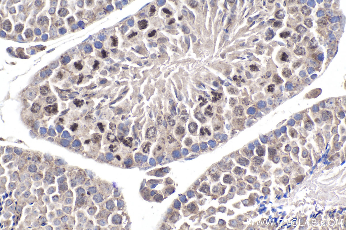 Immunohistochemical analysis of paraffin-embedded mouse testis tissue slide using KHC1909 (PBX4 IHC Kit).