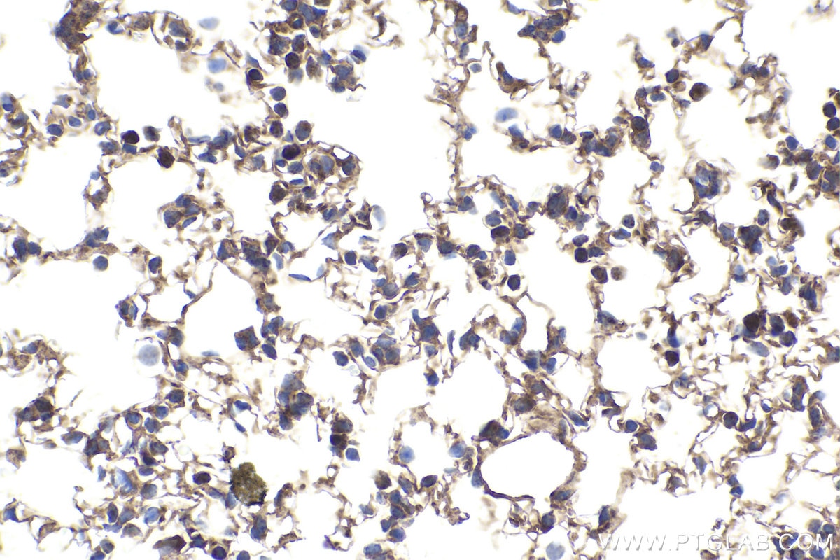 Immunohistochemical analysis of paraffin-embedded mouse lung tissue slide using KHC1866 (PBXIP1 IHC Kit).