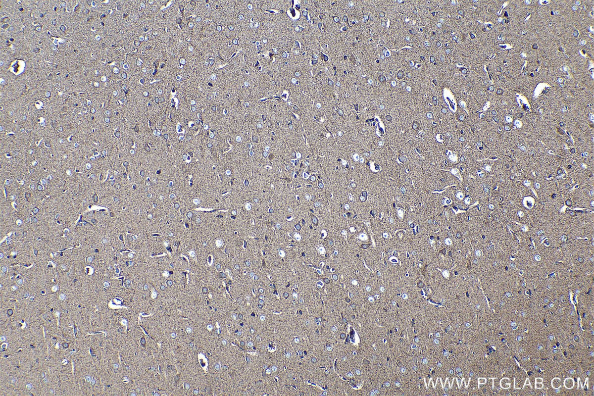 Immunohistochemical analysis of paraffin-embedded rat brain tissue slide using KHC1266 (PC IHC Kit).