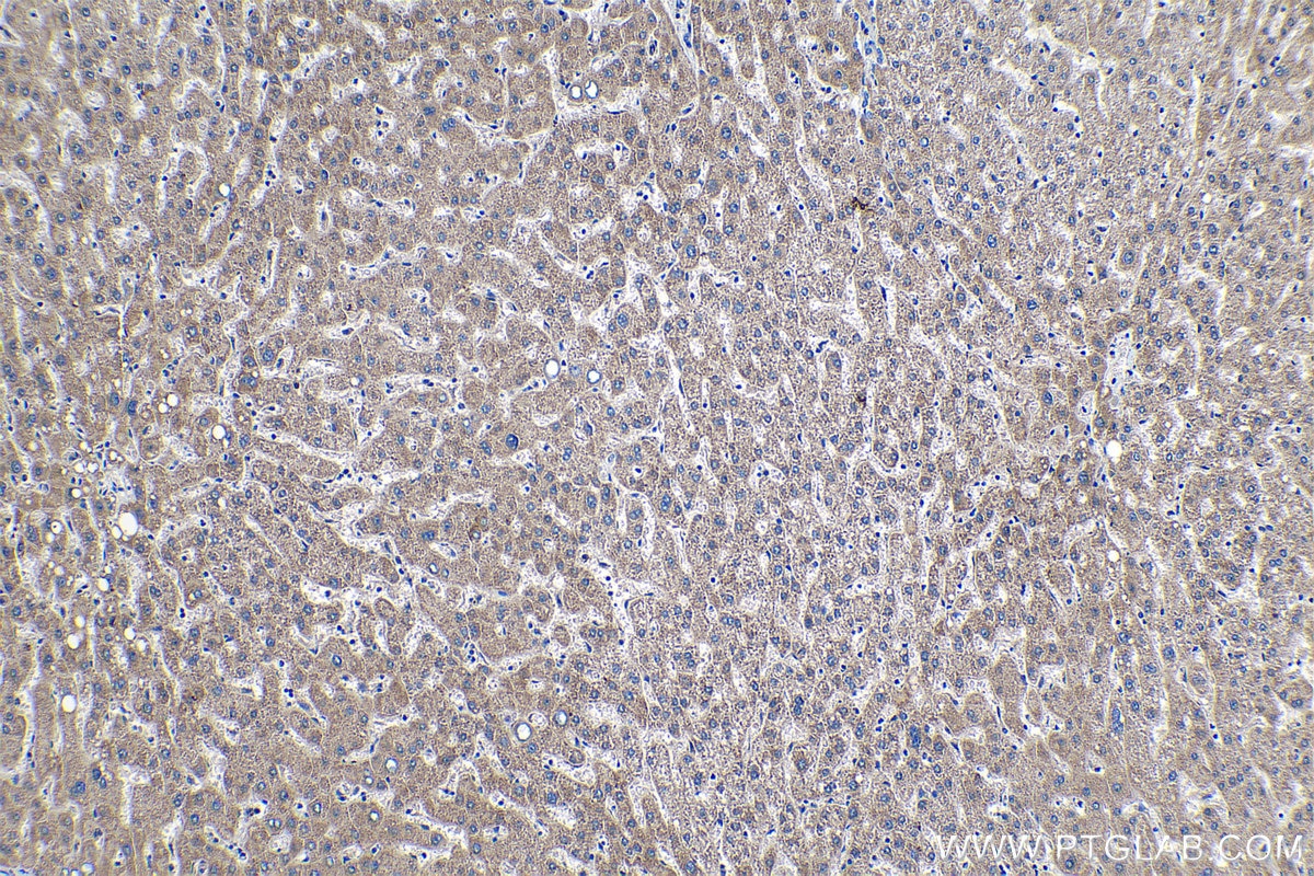 Immunohistochemical analysis of paraffin-embedded human liver tissue slide using KHC1266 (PC IHC Kit).