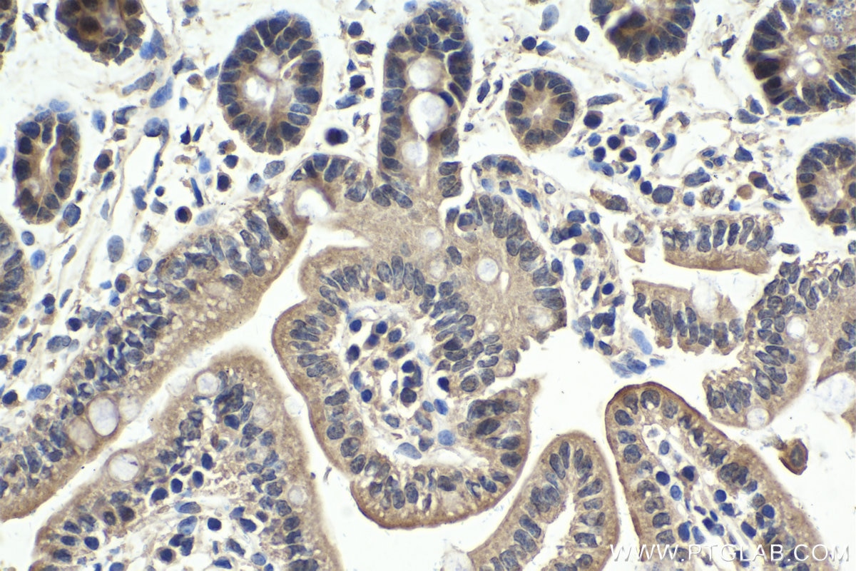 Immunohistochemical analysis of paraffin-embedded mouse small intestine tissue slide using KHC1642 (PCBD1 IHC Kit).