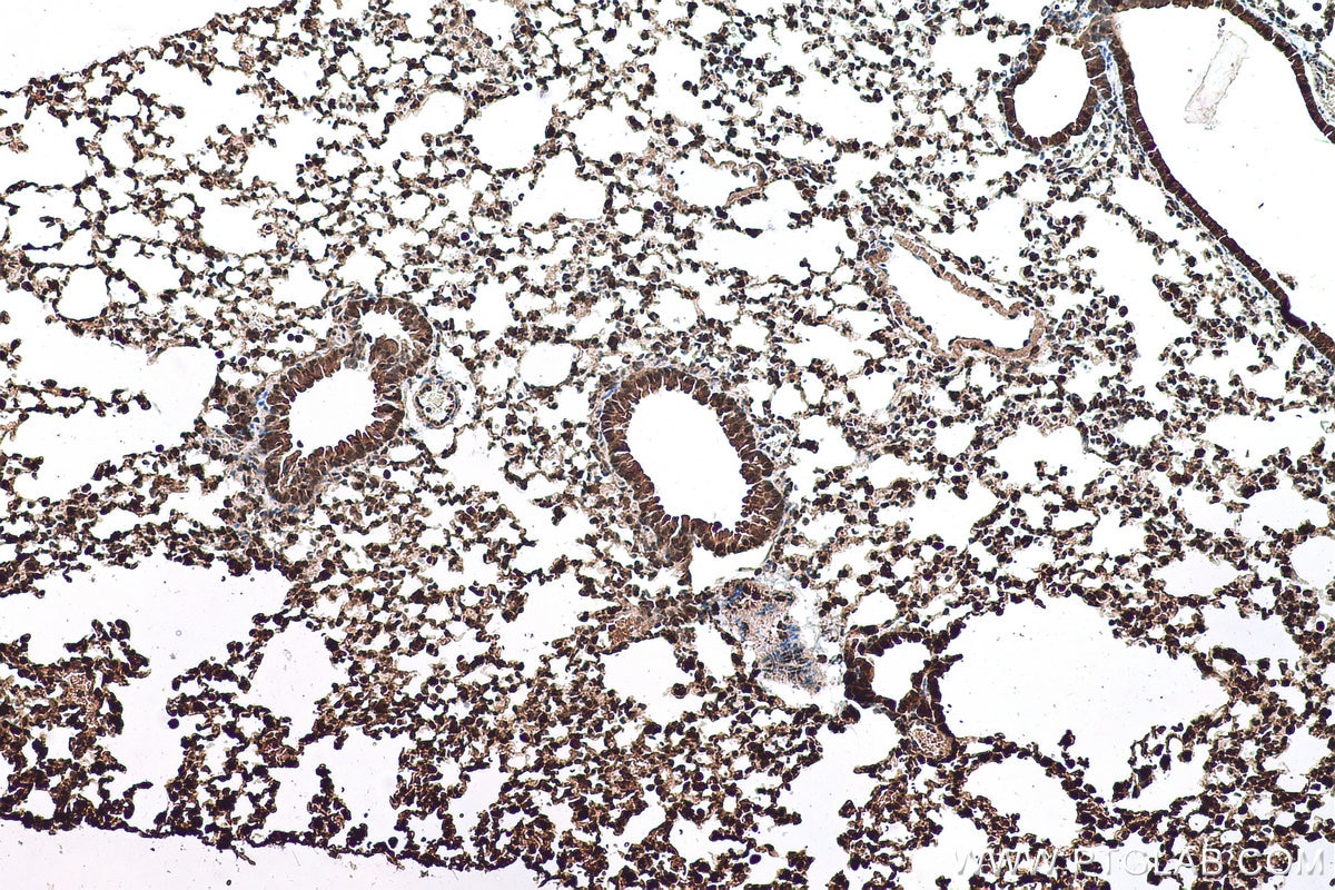 Immunohistochemical analysis of paraffin-embedded mouse lung tissue slide using KHC0740 (PCBP1 IHC Kit).