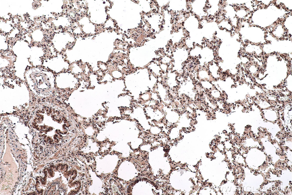 Immunohistochemical analysis of paraffin-embedded rat lung tissue slide using KHC0740 (PCBP1 IHC Kit).