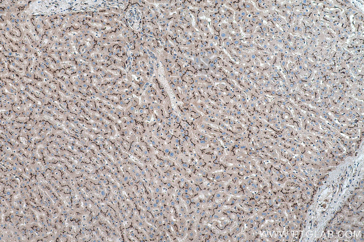 Immunohistochemical analysis of paraffin-embedded human liver tissue slide using KHC0258 (PCDH24 IHC Kit).