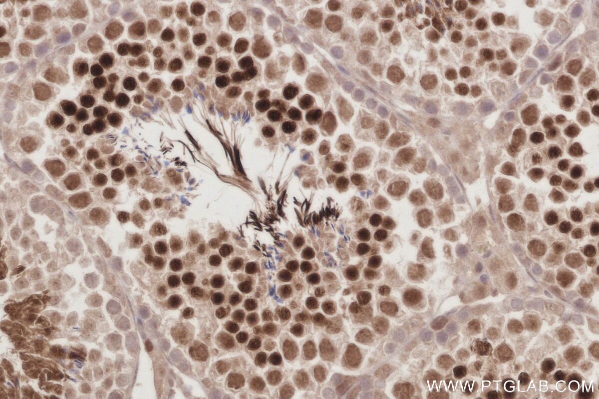 Immunohistochemical analysis of paraffin-embedded mouse testis tissue slide using KHC2886 (PCGF6 IHC Kit).