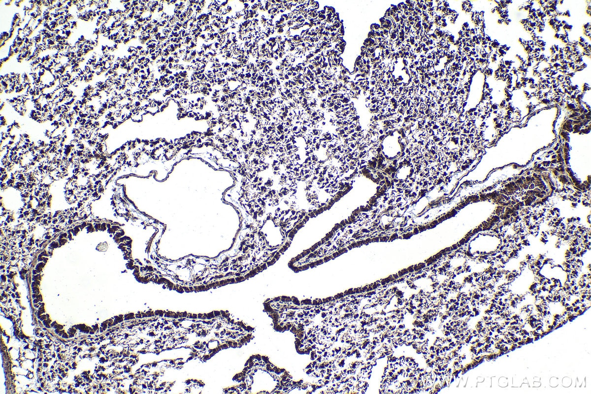 Immunohistochemical analysis of paraffin-embedded mouse lung tissue slide using KHC1775 (PCID2 IHC Kit).