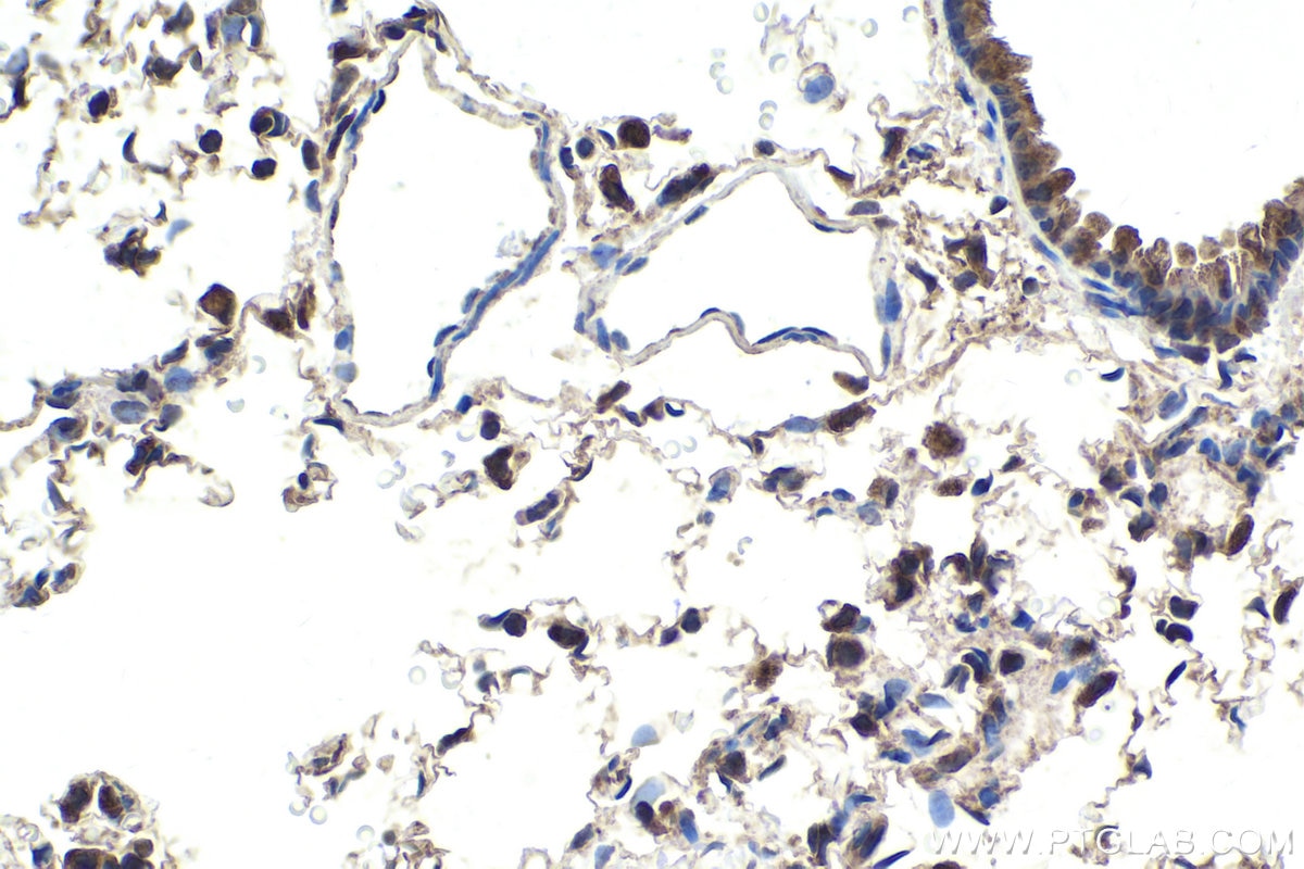 Immunohistochemical analysis of paraffin-embedded rat lung tissue slide using KHC1775 (PCID2 IHC Kit).