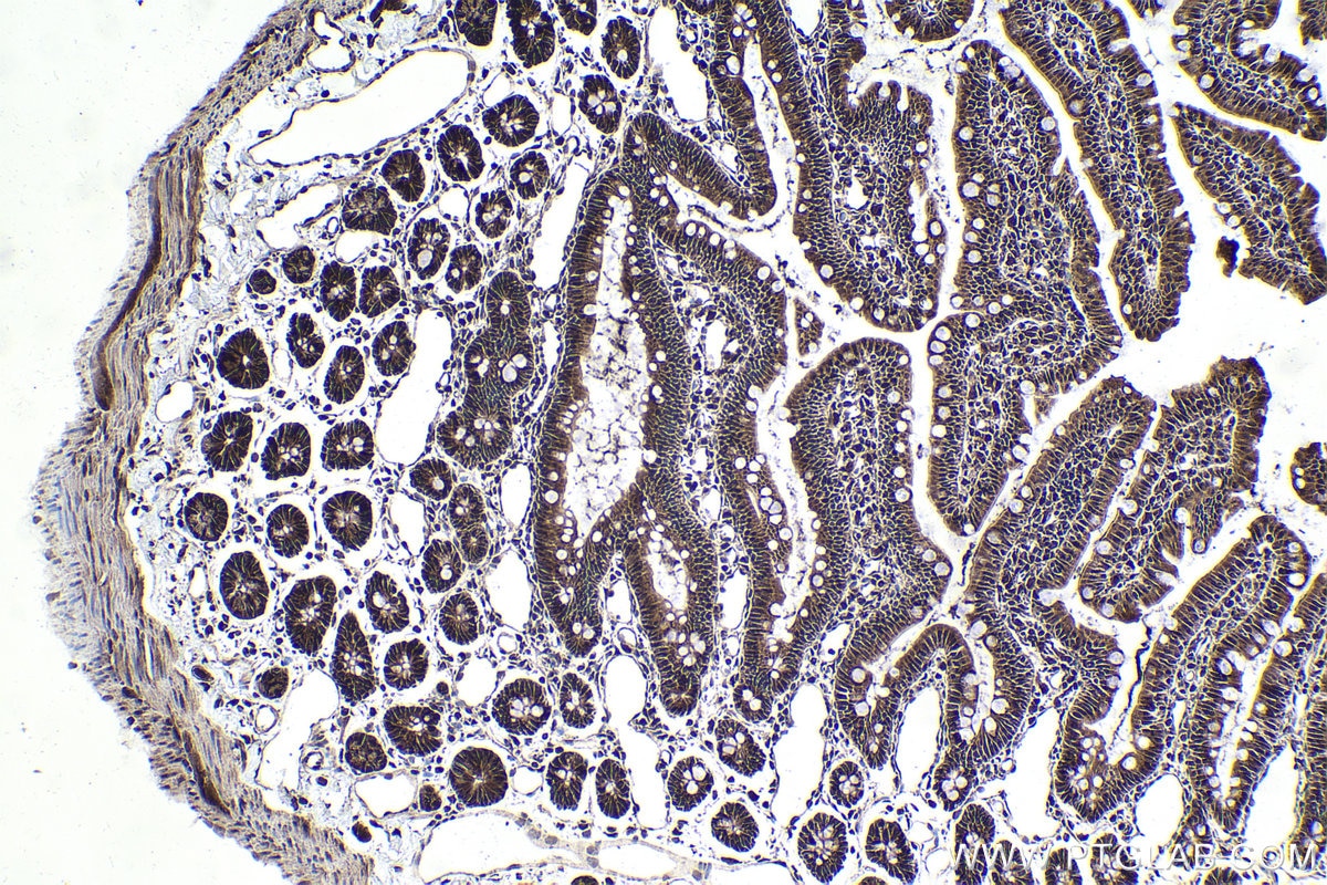 Immunohistochemical analysis of paraffin-embedded rat small intestine tissue slide using KHC1775 (PCID2 IHC Kit).