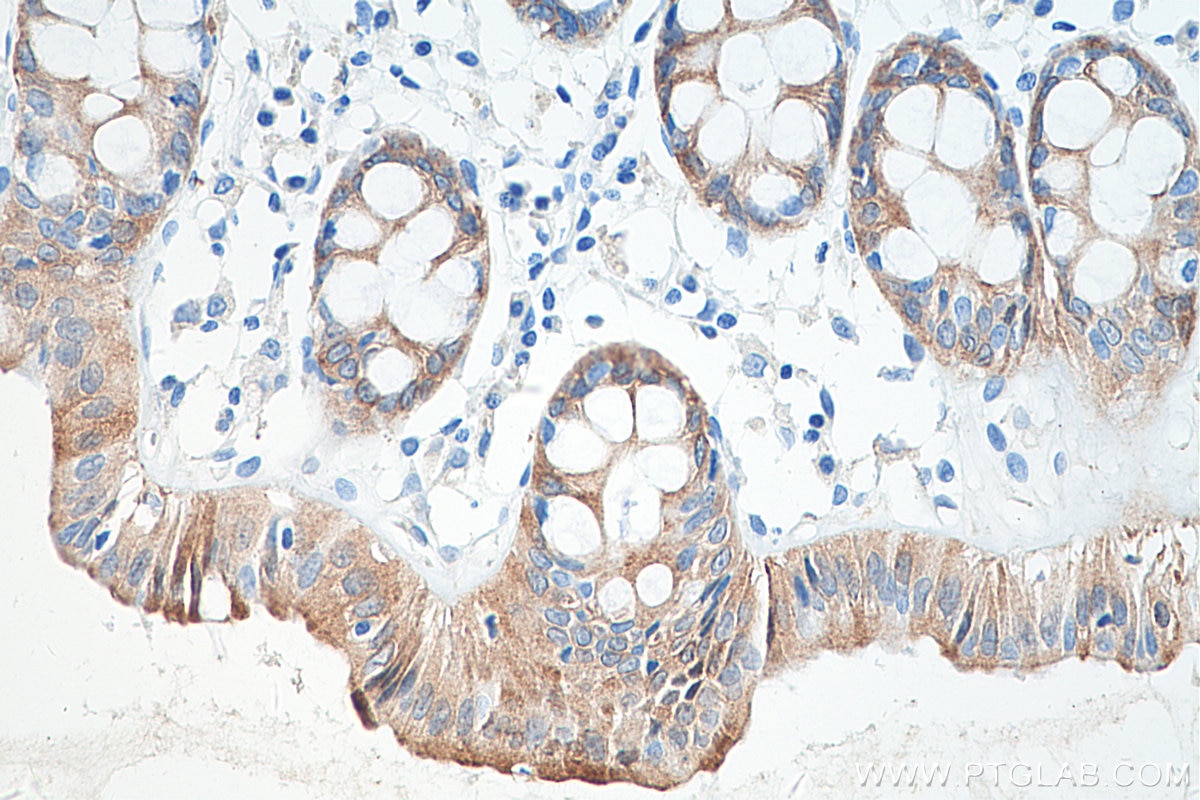 Immunohistochemical analysis of paraffin-embedded human colon tissue slide using KHC0231 (PCK1 IHC Kit).