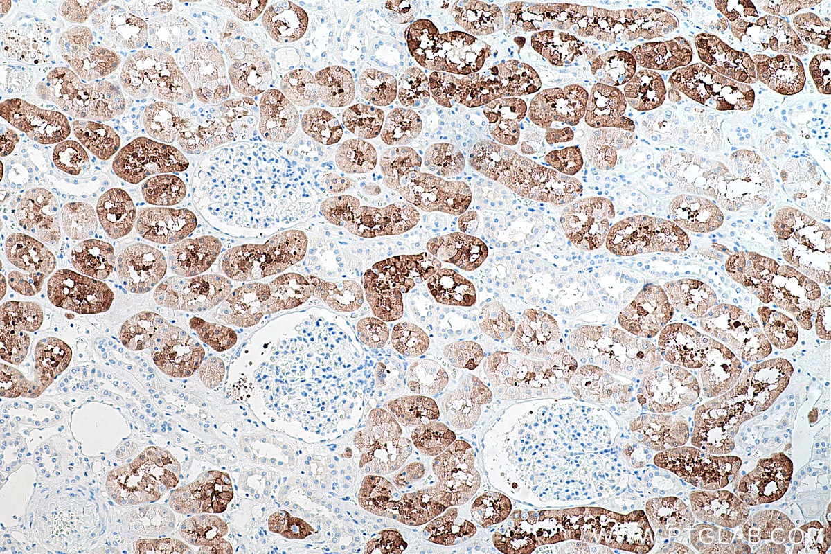 Immunohistochemical analysis of paraffin-embedded human kidney tissue slide using KHC0231 (PCK1 IHC Kit).