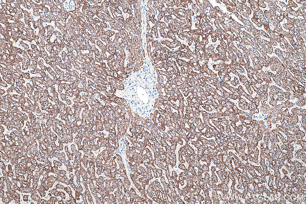 Immunohistochemical analysis of paraffin-embedded human liver tissue slide using KHC0232 (PCK2 IHC Kit).