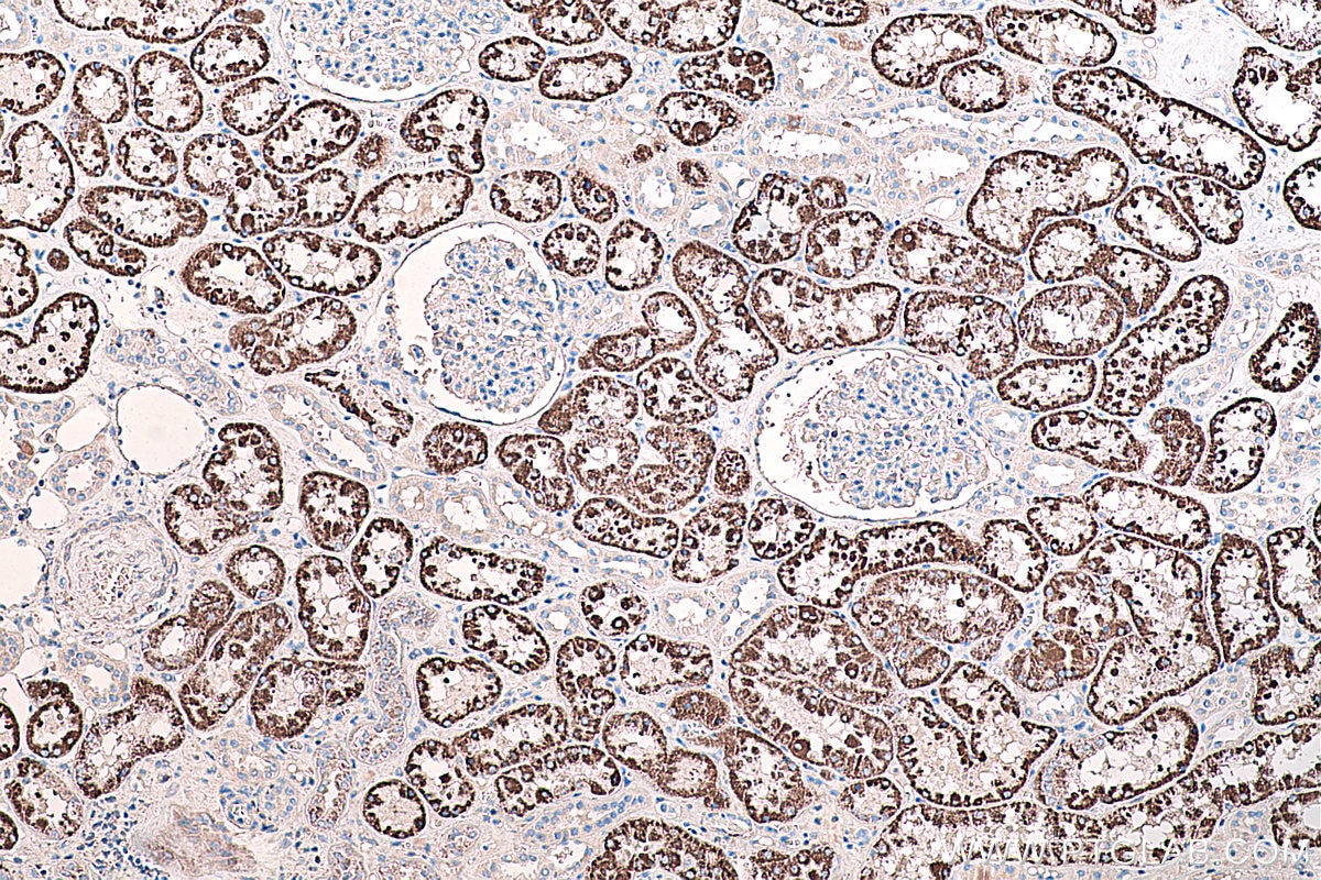 Immunohistochemical analysis of paraffin-embedded human kidney tissue slide using KHC0232 (PCK2 IHC Kit).