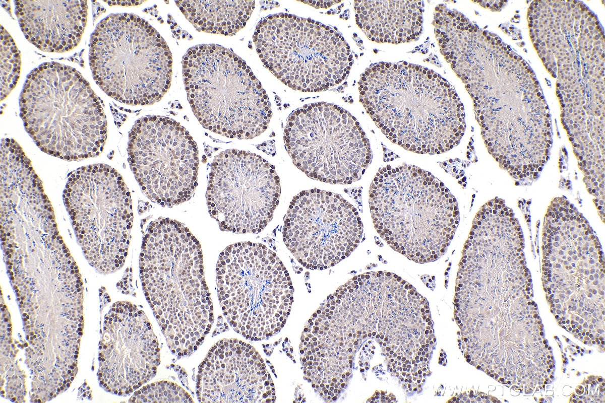 Immunohistochemical analysis of paraffin-embedded mouse testis tissue slide using KHC2182 (PCNA IHC Kit).