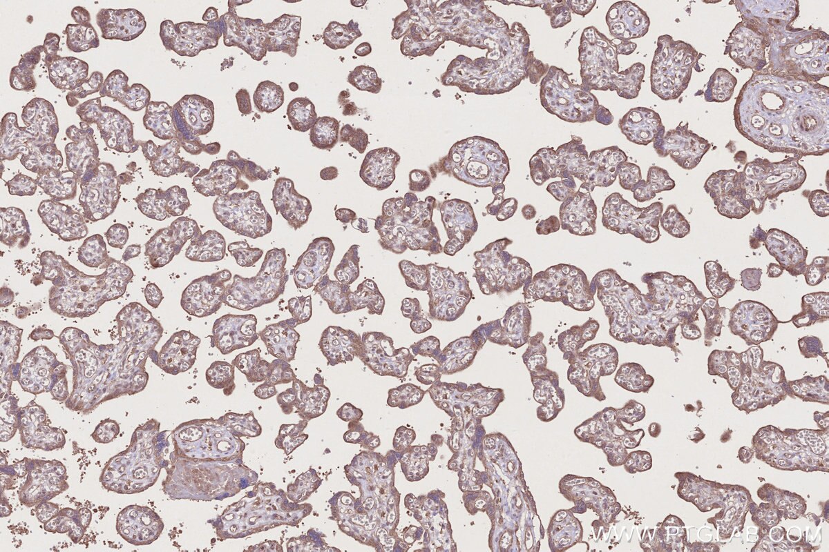 Immunohistochemical analysis of paraffin-embedded human placenta tissue slide using KHC2756 (PCSK5 IHC Kit).