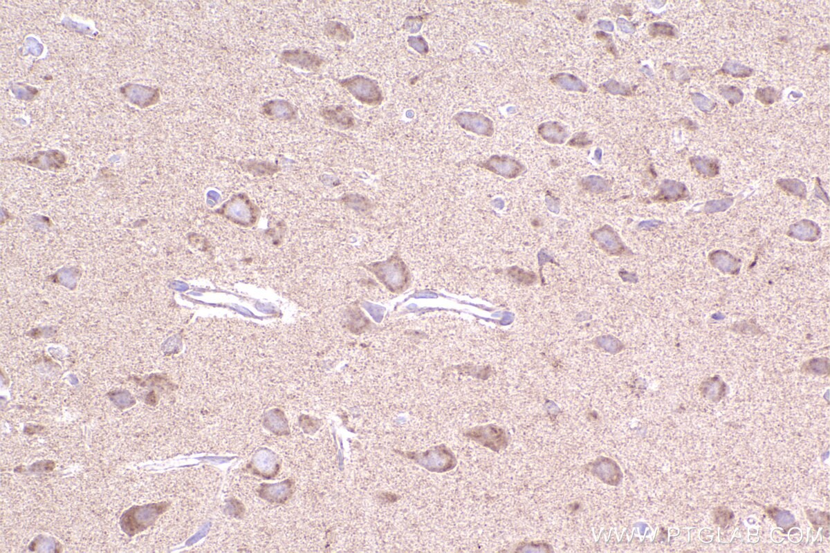Immunohistochemical analysis of paraffin-embedded rat brain tissue slide using KHC2398 (PCTAIRE3 IHC Kit).