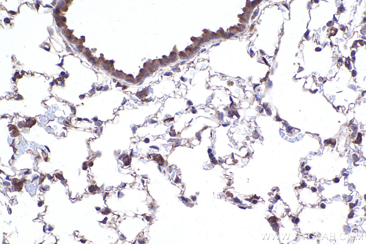 Immunohistochemical analysis of paraffin-embedded mouse lung tissue slide using KHC2398 (PCTAIRE3 IHC Kit).